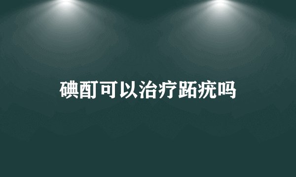 碘酊可以治疗跖疣吗