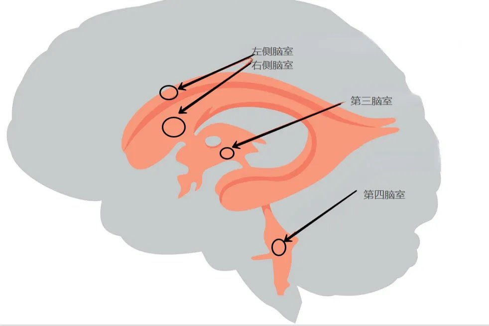 四个脑室位置图片