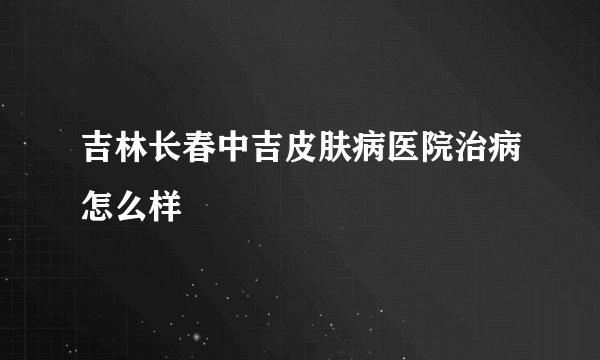 吉林长春中吉皮肤病医院治病怎么样