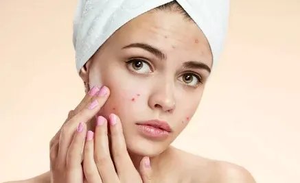 飞针祛痘多少钱?