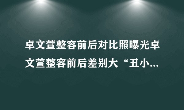 卓文萱整容前后对比照曝光卓文萱整容前后差别大“丑小鸭”完美蜕变成“天鹅”
