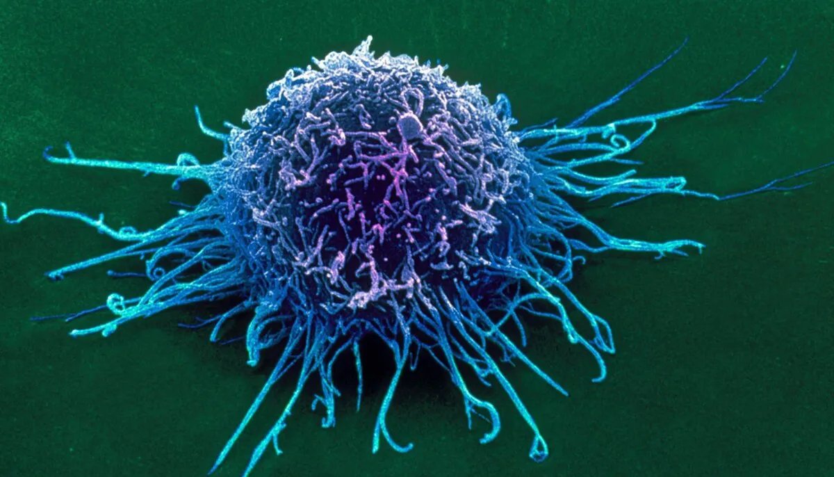 除了指甲和头发，全身都有可能长癌！人体最易患癌的15个部位