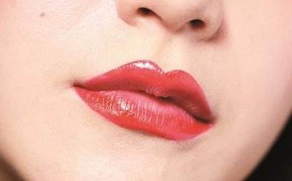 做丰唇手术多少钱