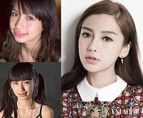 杨颖黄晓明整容前后照片曝光被称“假脸夫妇”