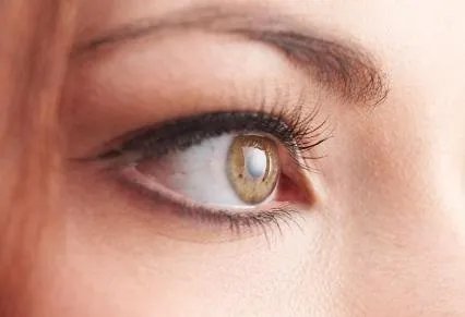 开内眼角整形天津哪家医院好