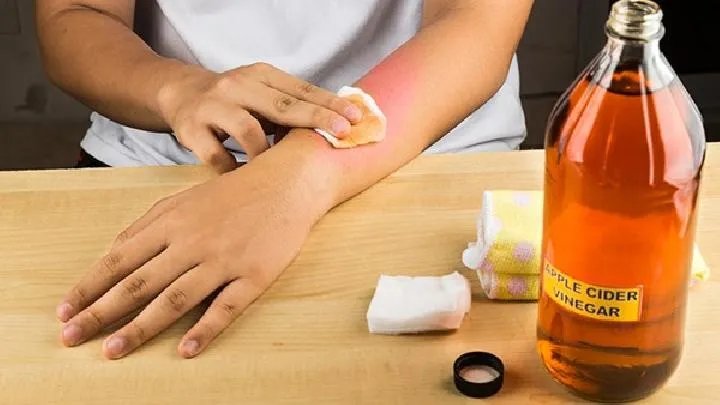 治疗黄褐斑医院如何挑选