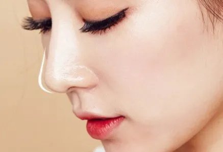 打玻尿酸效果能维持多久