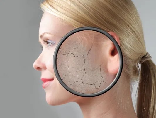 怎样可以去红血丝