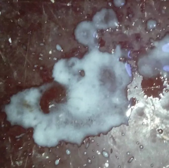 流米汤一样的分泌物图片