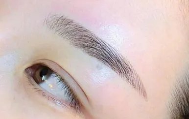 北京哪里做双眼皮效果比较好