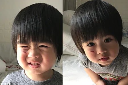 林志颖儿子跌伤脸粉丝很心疼 小志晒演唱会照片气氛热烈