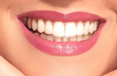 注射胶原蛋白丰唇手术多少钱