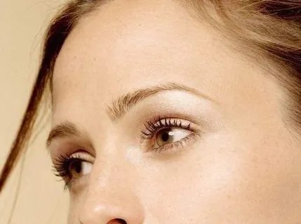 去掉抬头纹费用要多少钱