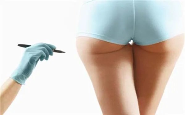 全身吸脂减肥手术价格