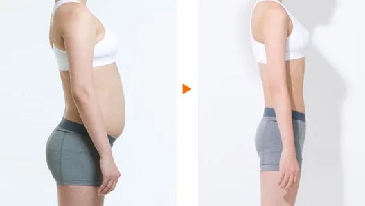 抽脂减肥一般多少钱