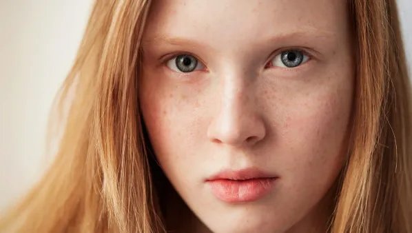 去除黄褐斑的土方法