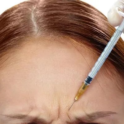 保妥适除皱副作用