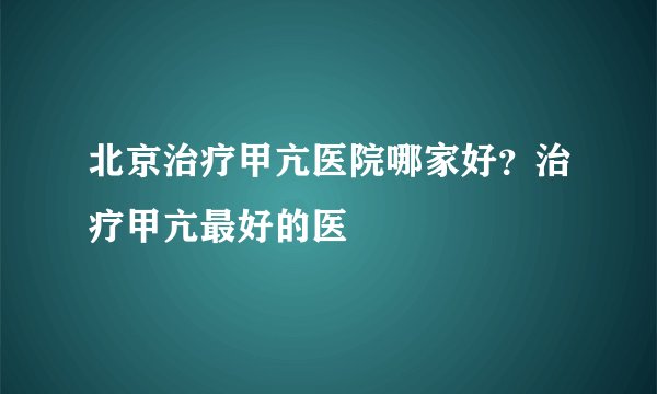 北京治疗甲亢医院哪家好？治疗甲亢最好的医
