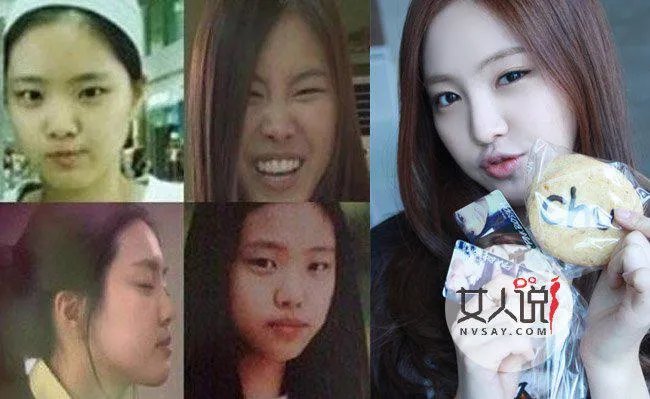 孙娜恩整容前后对比照片 孙娜恩家里很有钱吗