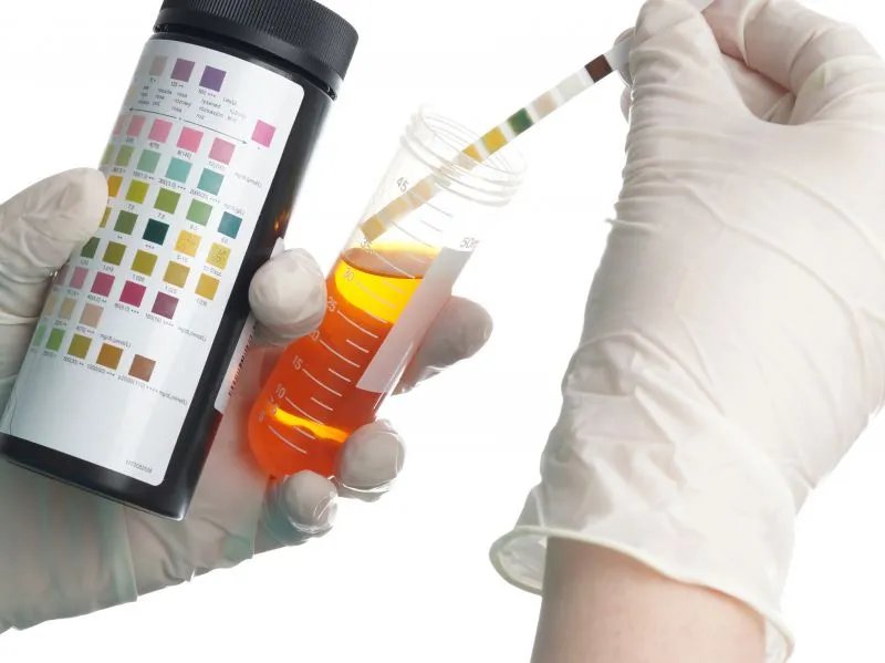 尿蛋白如何治疗