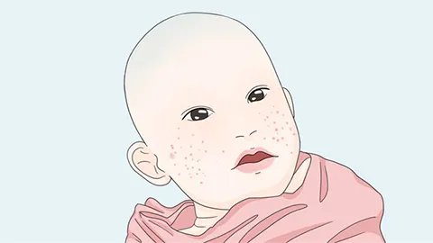 8个月宝宝拉稀怎么办