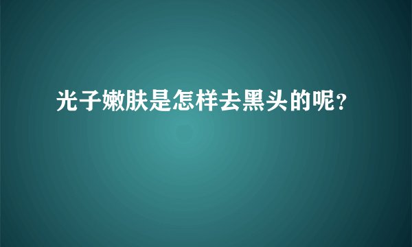 光子嫩肤是怎样去黑头的呢？