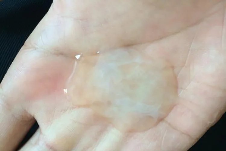 流米汤一样的分泌物图片