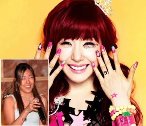 少女时代整容前后照片 整容前后对比让人伤心