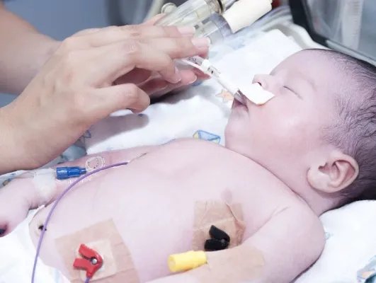 小儿黄疸有什么症状