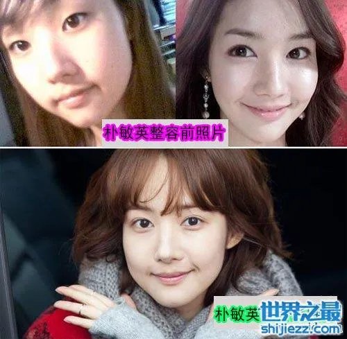 朴敏英整容前后照片对比，简直丑女大翻身 