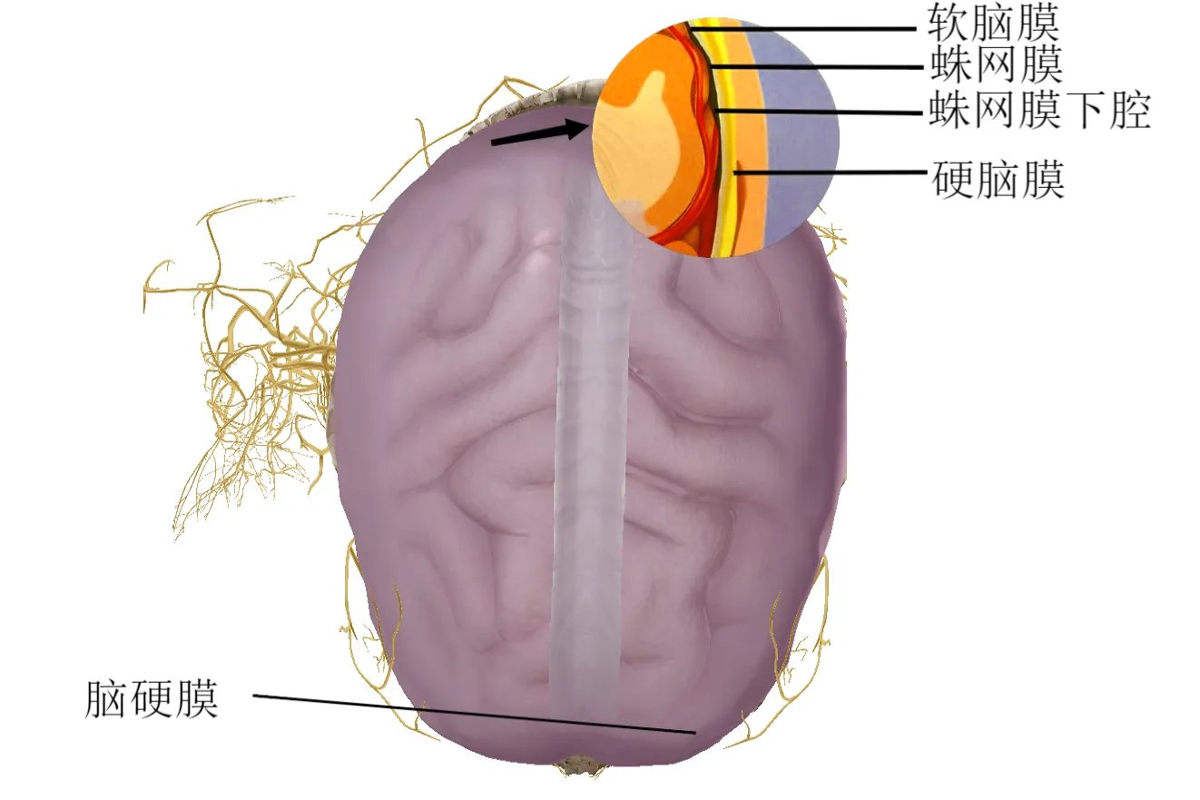 头顶位置图解大全图片