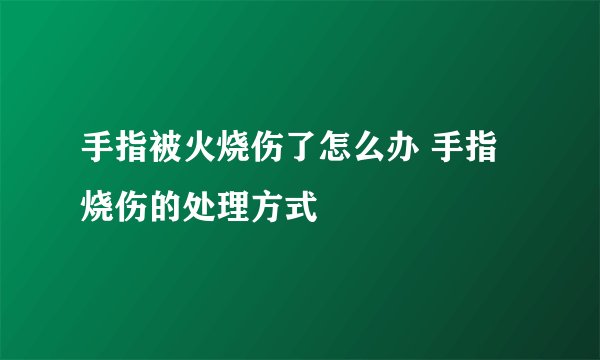 手指被火烧伤了怎么办 手指烧伤的处理方式