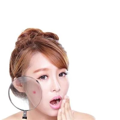 哪里治疗青春痘好和治疗