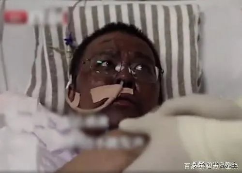 胡卫峰医生脑出血严重吗？恢复情况怎么样？