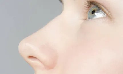 硅胶隆鼻一般需要多少钱