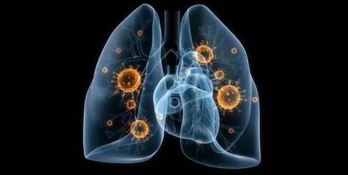 新疆新增确诊27例无症状12例，无症状是抵抗力强的吗？