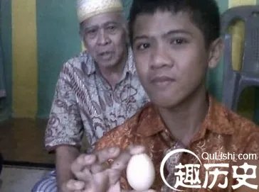 12岁男童离奇产蛋：一连产14颗究竟为何？