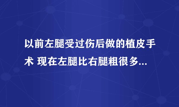以前左腿受过伤后做的植皮手术 现在左腿比右腿粗很多 我怎样才能把左腿变成和右腿一样粗