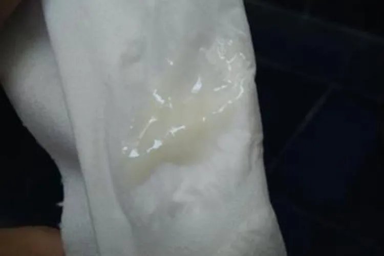 流米汤一样的分泌物图片