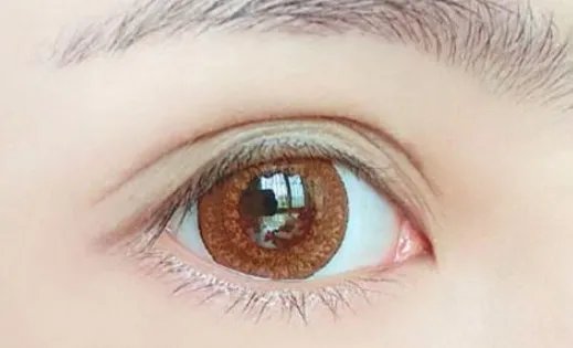 北京双眼皮手术多少钱