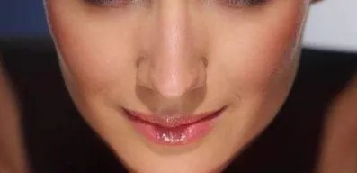 吸脂瘦脸手术风险