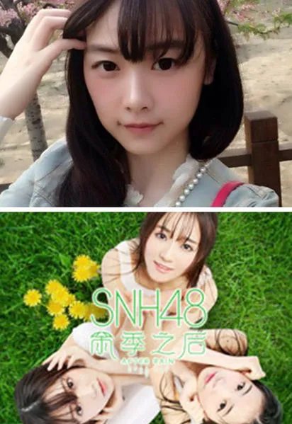 唐安琪脸部植皮病情稳定 事情原因扑所迷离