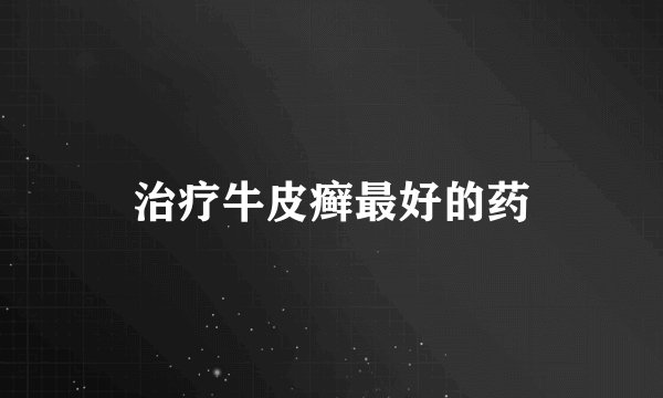 治疗牛皮癣最好的药