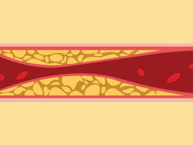 身体有这4个信号，说明你的血液粘稠如粥，警惕血管堵塞