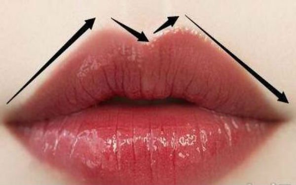 嘴巴怎么整形