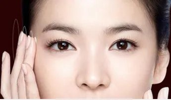 玻尿酸注射丰太阳穴多少钱