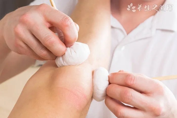 关节炎的治疗方法有哪些