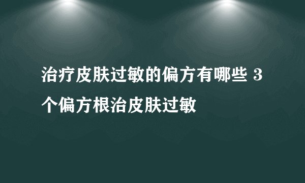 治疗皮肤过敏的偏方有哪些 3个偏方根治皮肤过敏
