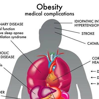 胆结石怎么治疗最好方法