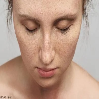 怎样祛斑效果好